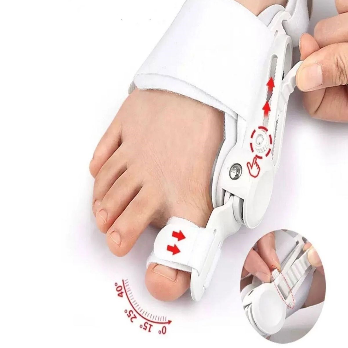 Ayarlanabilir Ayak Baş Parmak Kemik Düzeltici – Halluks Valgus (Bunyon) Aparatı, Gece Gündüz Kullanıma Uygun Ayak Düzeltme Ateli